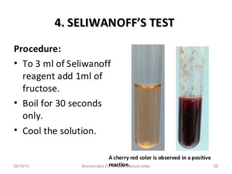 seliwanoff's test|qualitative test of carbohydrates.